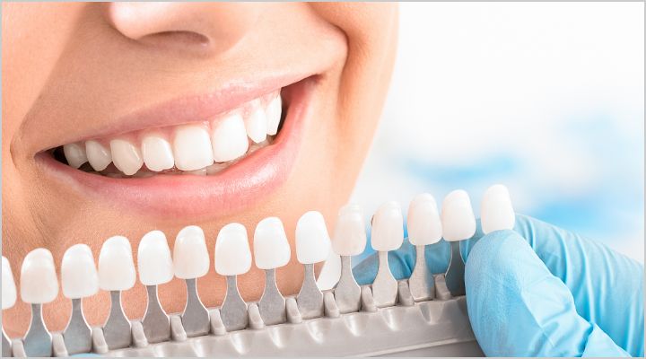 ホワイトニング・その他