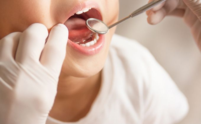 小児歯科・予防